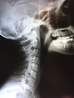 chiropractor north hollywood