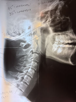 chiropractor.jpg
