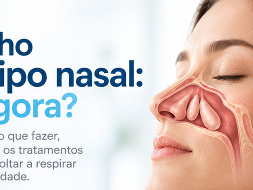 Tenho Pólipos Nasais: O Que Fazer? Guia Médico Completo Sobre Tratamentos, Cirurgia e Imunobiológicos