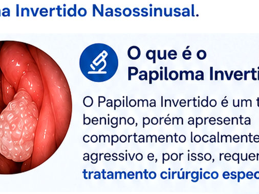 A prevalência é maior entre homens, especialmente na faixa etária entre a quarta e a sétima década de vida, o que reforça a necessidade de vigilância constante em pacientes nessa fase. O sintoma que mais frequentemente leva o paciente ao consultório é a obstrução nasal unilateral. É como se houvesse uma barreira física que impede a passagem de ar apenas de um lado, muitas vezes acompanhada de rinorreia, que é a secreção nasal persistente. Outro sinal de alerta importante é a epistaxe recorrente, ou seja, sangramentos nasais sem causa aparente e frequentes. Em alguns casos, o paciente pode notar uma redução ou perda do olfato, conhecida como anosmia ou hiposmia, que impacta diretamente o prazer de comer e a segurança cotidiana. Sintomas secundários, como cefaleia intensa, sensação de peso na face ou alterações visuais, podem surgir conforme o tumor cresce e exerce pressão sobre as estruturas ósseas adjacentes. A agressividade local é, justamente, uma das características que distingue