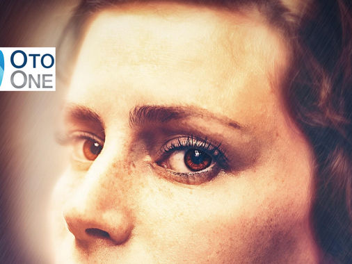 Como o senhor diagnostica a extensão do dano em sua clínica? O diagnóstico é feito através de uma avaliação minuciosa. O exame principal é a nasofibroscopia, onde utilizamos uma microcâmera de alta definição para visualizar todo o interior do nariz, o tamanho e a localização exata da perfuração. Em casos de colapso estrutural, uma tomografia computadorizada é solicitada para avaliar toda a arquitetura óssea e cartilaginosa remanescente. 12. É possível confundir esses sintomas com outras doenças? Sim. No diagnóstico diferencial, um especialista deve descartar outras condições que podem causar perfurações septais, como doenças autoimunes (granulomatose com poliangiite), doenças infecciosas (tuberculose, sífilis) e, mais raramente, tumores. A história clínica, associada aos exames, geralmente elucida o quadro. 13. Como é o tratamento para uma perfuração de septo? O tratamento para a perfuração de septo é cirúrgico. A técnica, chamada de septoplastia reconstrutiva, consiste em fechar o d