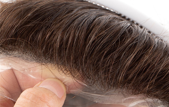 Hair replacement system