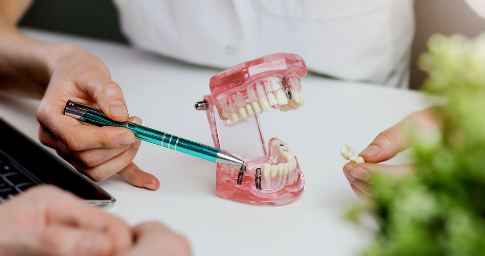Dental model demonstration showing placement of full-mouth implants, illustrating the importance of choosing an experienced implant team for this advanced, irreversible, and life-altering procedure.