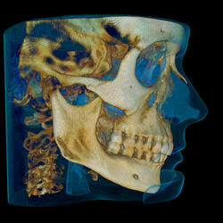 sitecore.media_library.Images.3D_Imaging.9300.Images.Image_Gallery.17x13_Ortho_profile