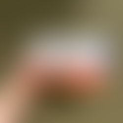 Naturlig hudfornyelse og glød med Vitaran