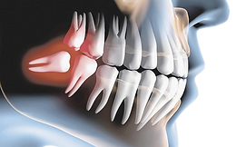 Cirurgia Bucal.png