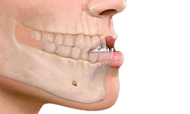 Ortognatica.png