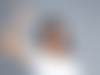 כמה זמן לוקח לשיער לצמוח אחרי השתלת שיער?