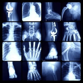 imagistica, radiografie, computer tomograf, RMN