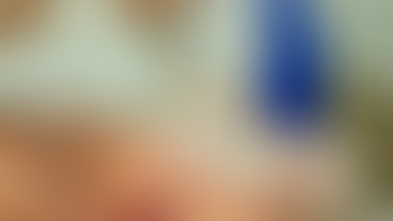 Ultraformer MPT: tecnologia para rejuvenescimento facial e corporal sem cirurgia