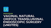 Vaginal Natural Orifice Transluminal Endoscopic Surgery (vNOTES) Podcasts