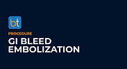 GI Bleed Embolization Podcasts