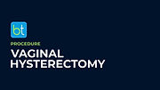 Vaginal Hysterectomy Procedure Prep