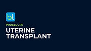 Uterine Transplant Podcasts