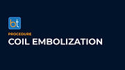 Coil Embolization Podcasts