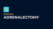 Adrenalectomy Podcasts