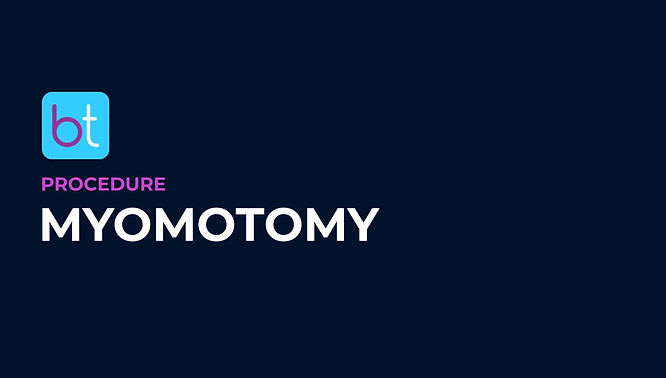 Myomotomy Procedure Prep