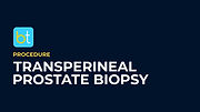 Transperineal Prostate Biopsy Procedure Prep