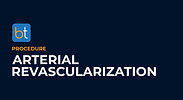 Arterial Revascularization Podcasts