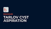 Tarlov Cyst Aspiration Podcasts