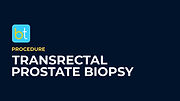 Transrectal Prostate Biopsy Procedure Prep