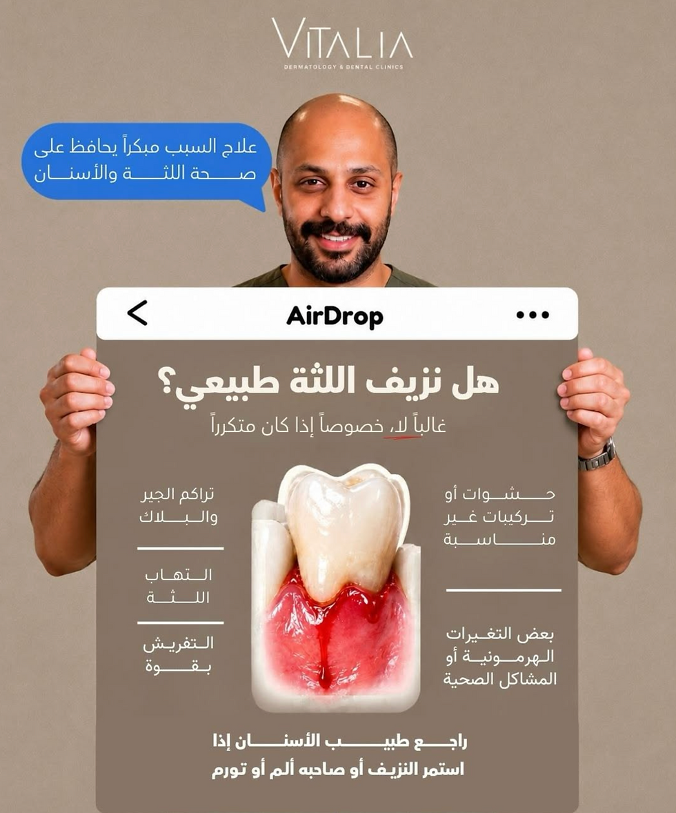  نزيف اللثة