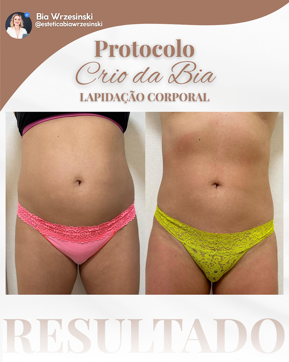 Protocolo Crio da Bia - Lapidação Corporal