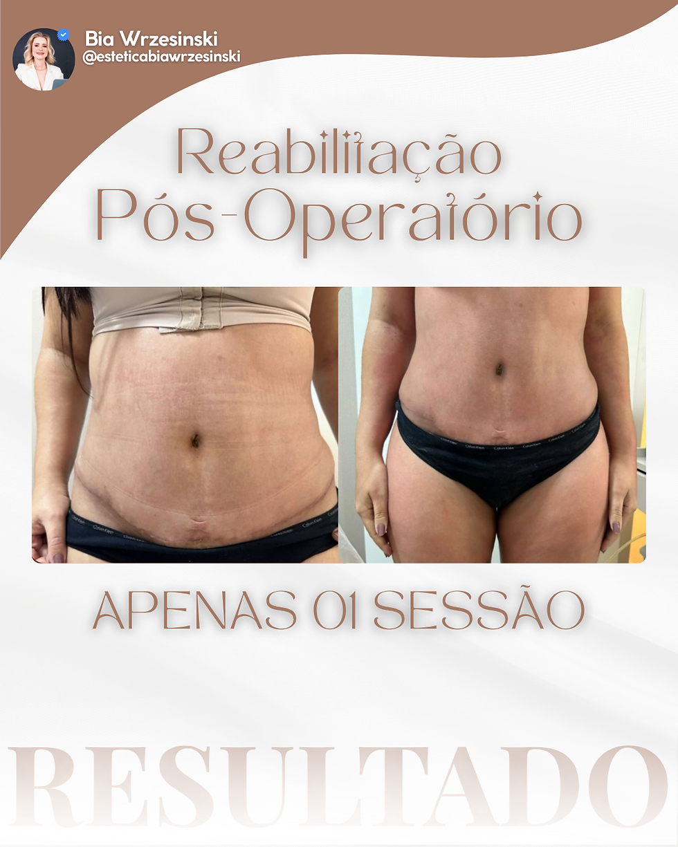 Reabilitação Pós-Operatório
