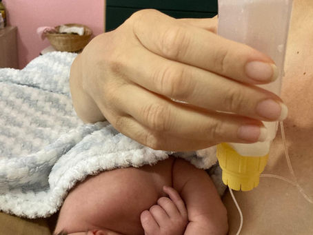Breastfeeding with Low Milk Production After Breast Surgery-Denise