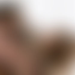 México, primer país en el mundo en lograr el registro de NUMELVI, tratamiento de segunda generación para la dermatitis alérgica en perros