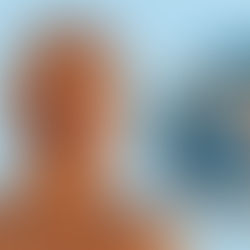 DETECTAN EN MÉXICO EL PRIMER POSIBLE CASO DEL HONGO NEGRO