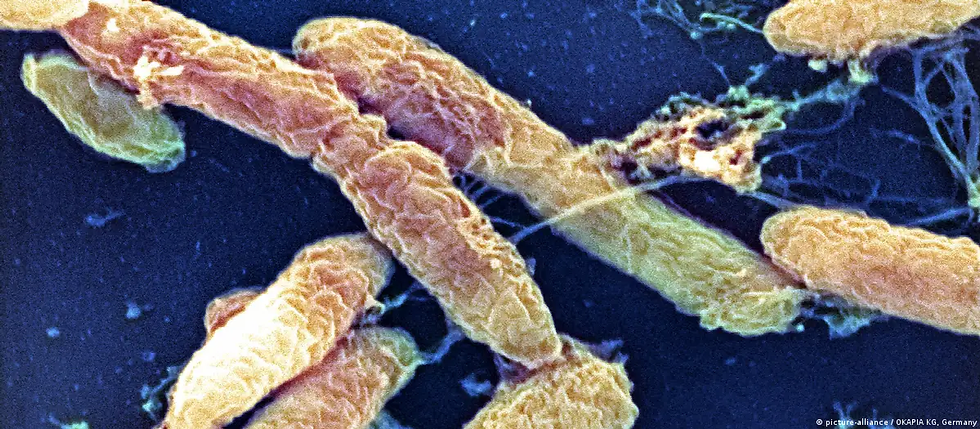 La muerte de una trabajadora de un laboratorio ruso que pudo haber estado expuesta a "Yersinia pestis", la bacteria causante de la peste, ha generado intensas especulaciones en redes sociales.