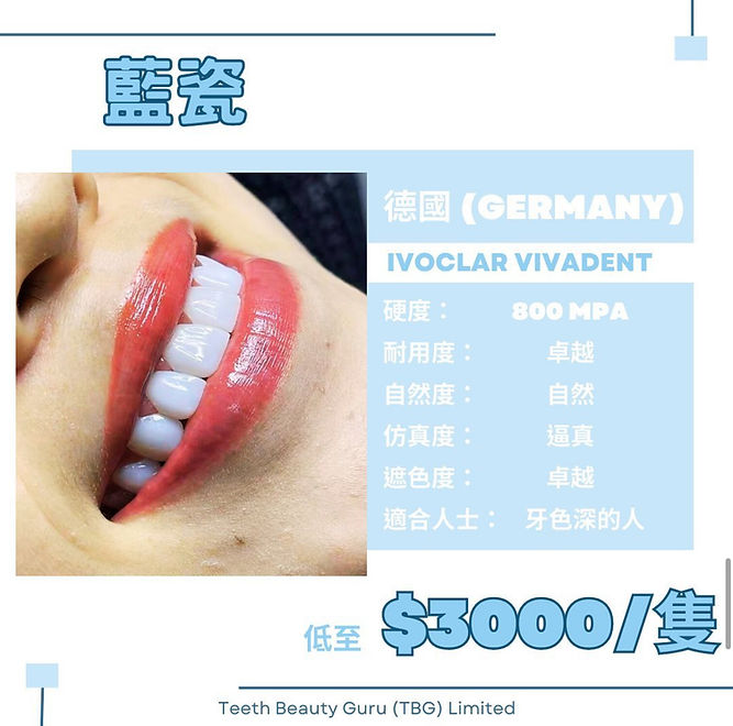 隱形牙套 箍牙 香港箍牙 免費線上評估 香港註冊牙醫 固定器 retainer 全瓷牙貼