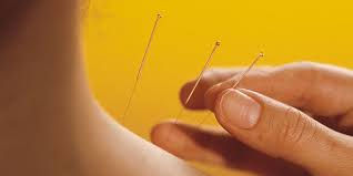Hands for Healing with Needles of Light