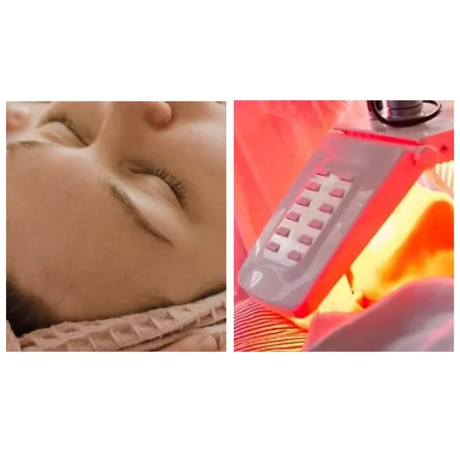 LED light facial Amsterdam