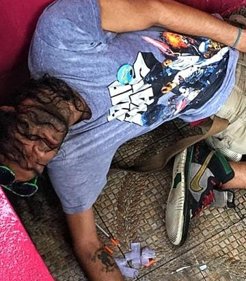 THE CORRELATION BETWEEN HEROIN USE AND CANCER