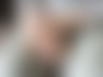 Anorexia do envelhecimento