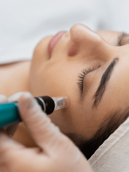 microneedling (2).png