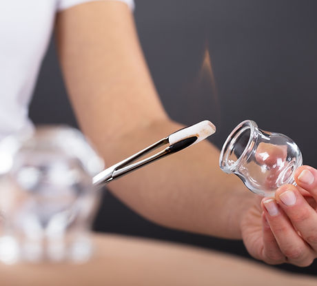 Close-up Of A Therapist Giving Cupping T
