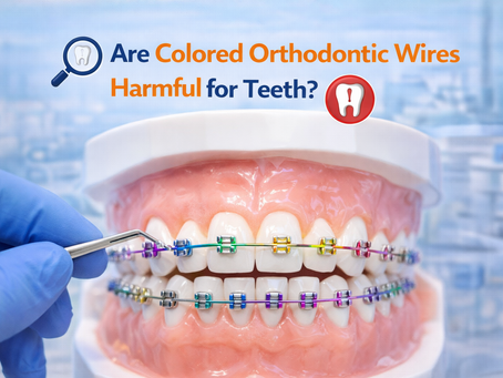 Are Colored Orthodontic Wires Harmful for Teeth?