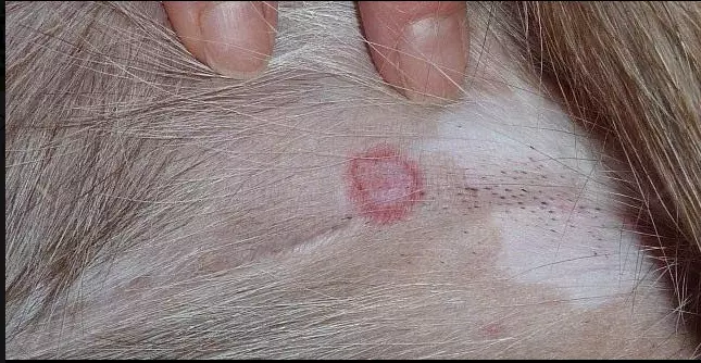 single black fly bite with dark red outline