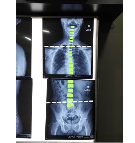 X Ray (1).jpg