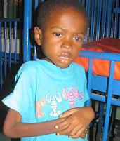 Severe Malnutrition