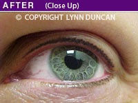 After Trichotillomania Eyelash Permanent Makeup (Close Up)