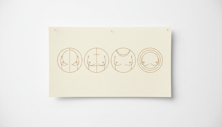 Eye-level view of a simple anatomical breast reduction incision diagram on neutral paper