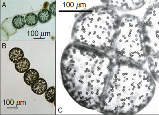 Microfotografias de células de Thiomargarita namibiensis em formato de grandes esferas com várias pequenas esferas no seu interior, que são as inclusões de enxofre, muito comum nessa espécie.