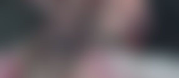 Réduire la fracture