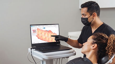 inter oral 3d scan