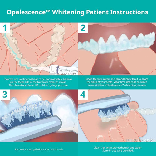 At-Home Teeth Whitening Kit (Dentist Approved