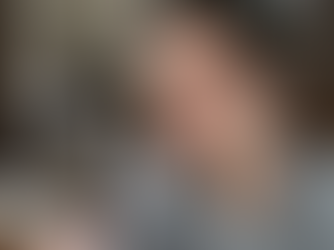 Blepharitis and Red Eyelids: The Hidden Cause of Dry Eye (Milwaukee Guide)